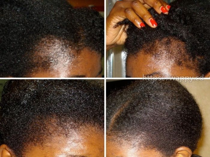 Huile pour le traitement de cheveux (huile pour la
